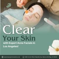 Clear Your Skin with Expert Acne Facials in Los Angeles!