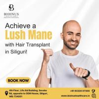 Achieve a Lush Mane with Hair Transplant in Siliguri!