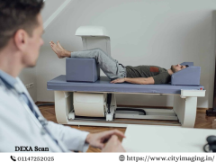 Dexa Scan Near Me – Find Accurate Results