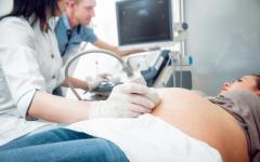 4d sonography in pregnancy