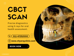 CBCT Scan Price What to Expect in 2024