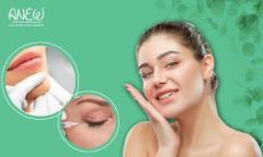 Best Threads Treatment in Bangalore - Anew Cosmetic Clinic