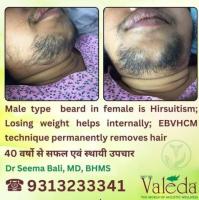 PERMANENT TREATMENT FOR UNWANTED HAIR VALEDA EBHCM