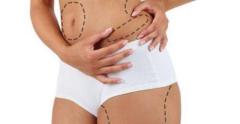 Liposuction Surgery Cost in Delhi - Dr Rajat Gupta