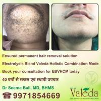 PERMANENT TREATMENT FOR UNWANTED HAIR VALEDA EBHCM