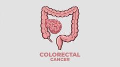 Highly Recommended Colorectal Surgeon in Glendale – Schedule Today!