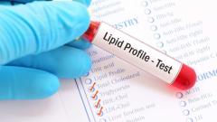 Lipid Profile Test in Chandigarh – Comprehensive Cholesterol Screening