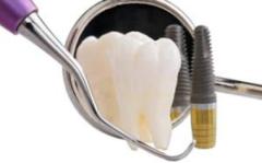 Unmatched Quality Dental Implants in Melbourne for Superior Results