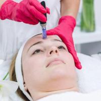 Microneedling Radiofrequency Services 