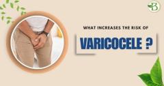 Effective, Non-Surgical Varicocele Treatment at Bharat Homeopathy