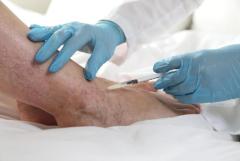 Best varicose vein treatment In New Jersey | Advanced Medical Group