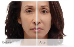 Transformative Facial Plastic Surgery NYC – My Face Surgeon