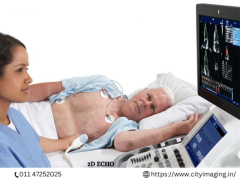 Affordable 2D Echo Test Price Your Guide to Heart Health 