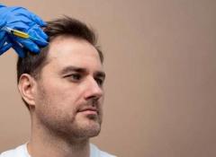 Best Hair Transplant in South Delhi