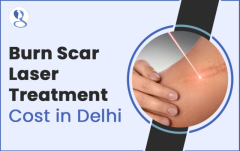 Burn Scar Laser Treatment Cost In Delhi - Mehektagul Dermaclinic