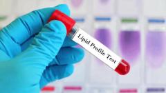 Lipid Profile Test Cost in Chandigarh  