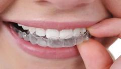 Best Orthodontist in Chandigarh for Perfect Smiles  