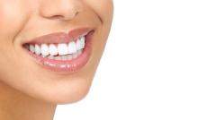 Understanding Dental Veneer Cost: What You Need to Know  