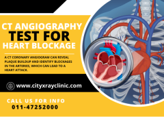 CT Coronary Angiography Price Affordable & Accurate Scans 