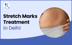 Stretch Marks Treatment In Delhi | Mehektagul Dermaclinic