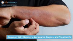 Simple Guide to Skin Disorders: Symptoms and Treatments