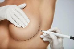 Best Breast Augmentation surgery in Ahmedabad