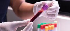 Best Blood Test Lab in Panchkula | Uno Pathology Labs