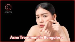 Acne Treatment in Bangalore 