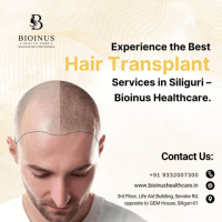 Experience the Best Hair Transplant Services in Siliguri – Bioinus Healthcare