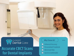 Accurate CBCT Scans for Dental Implants