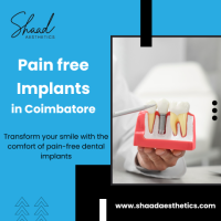 Pain free Implants in Coimbatore