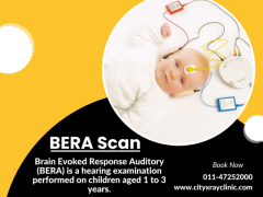 BERA Test Price Cost Breakdown