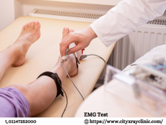 EMG Test Cost Understand Pricing