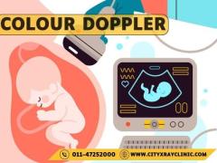 Color Doppler Ultrasound Price Guide Affordable Costs Explained