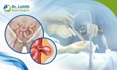 Best Hernia Surgery in Bangalore - Dr. Lohith U