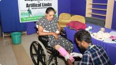 Transforming Lives Through Artificial Limb Surgery with Narayan Seva 