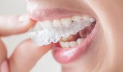 Invisalign Braces Cost in India: A Comprehensive Guide