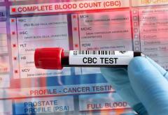 Lipid Profile Test in Chandigarh - Accurate and Affordable Testing