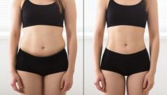 Lipo Laser Treatment: Achieve Your Body Goals with Ease