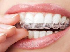 Choose Invisalign for Your Teeth Straightening Journey