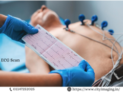 ECG Test Price Delhi Affordable Options