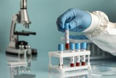 Best Blood Test Lab in Chandigarh - Accurate & Reliable Diagnostics