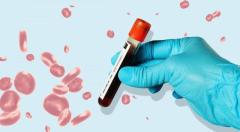 Book Blood Test for Malaria Online - Max Lab