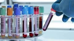 Best Pathology Lab in Panchkula – Accurate and Reliable Testing Services