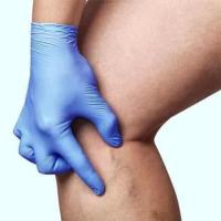 Why Choose Our Centers for Vein Treatment in New Jersey?