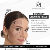 Adhia Aesthetic Clinic | The Best Skin Care Clinic In Chennai