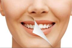 Understanding Teeth Whitening Costs in India: A Comprehensive Guide