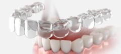 WHY PROPER TEETH ALIGNMENT IS ESSENTIAL FOR ORAL HEALTH