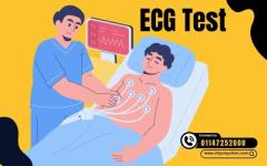 ECG Test Price Delhi Affordable Rates