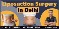 Liposuction in Delhi: A Comprehensive Guide to Body Contouring